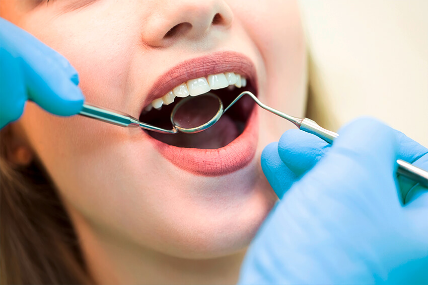 bakteriellen Entzündungsprozesse betreffen Zahnfleisch und/ oder Knochen und führen als Folge zu Zahnlockerung und auf Dauer zu Zahnverlust